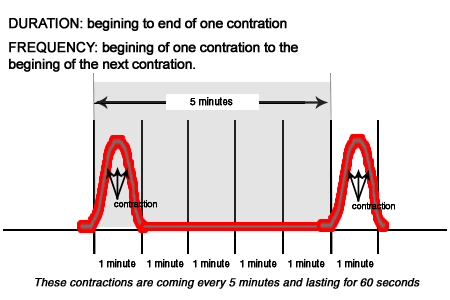 How To Time Contractions Chart